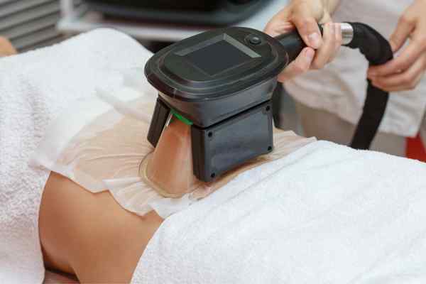 Areas of the Body we treat Cryolipolysis Falkirk