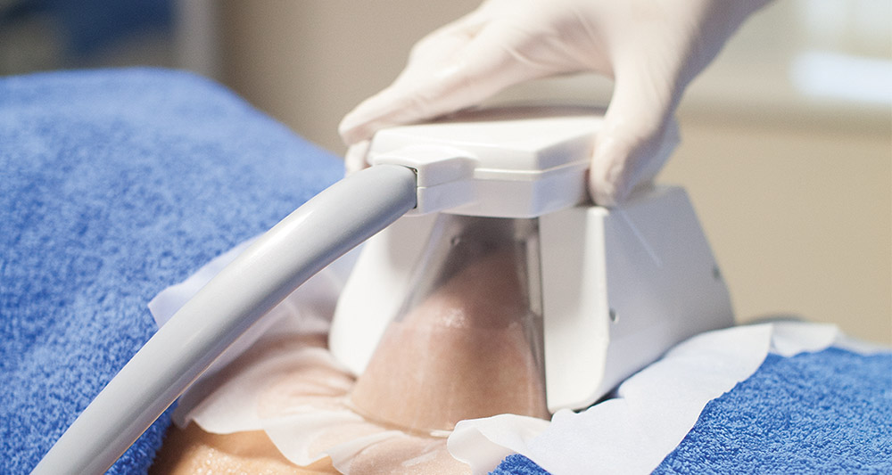 How Fat Freezing and HIFU Work Together? 2 Multiple Areas in One Session HIFU and Fat Freezing Falkirk