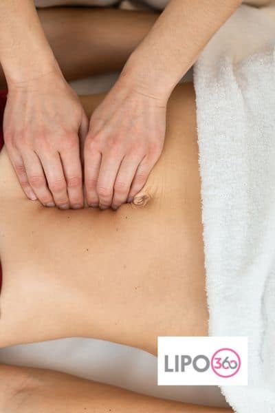 diastasis recti treatment Falkirk
