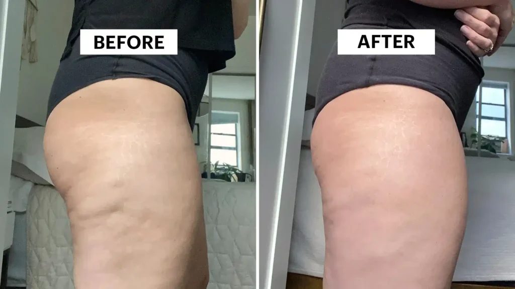 Do Toning Exercise Falkirk Really Tackle Cellulite?