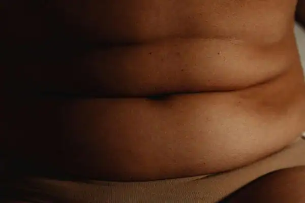 The Hidden Connection: How Stress Shapes Your Fitness and Body Composition 3 image of what stress can do on the stomach area and how Lipo 360 Falkirk can help to change your body shape.