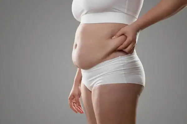 Image of stress belly Falkirk How Lipo 360 can help manage your symptoms